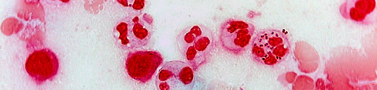 Imatge al microscopi de Neisseria gonorrhoeae